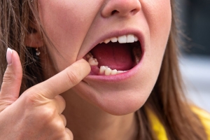 Get Dental Implants Get Dental Implants